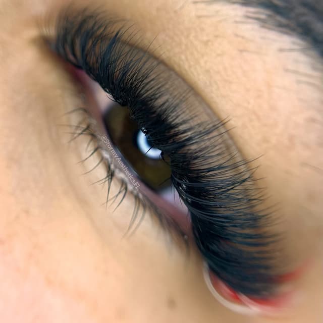 Volume at Stormy Aesthetics in Clearwater, FL